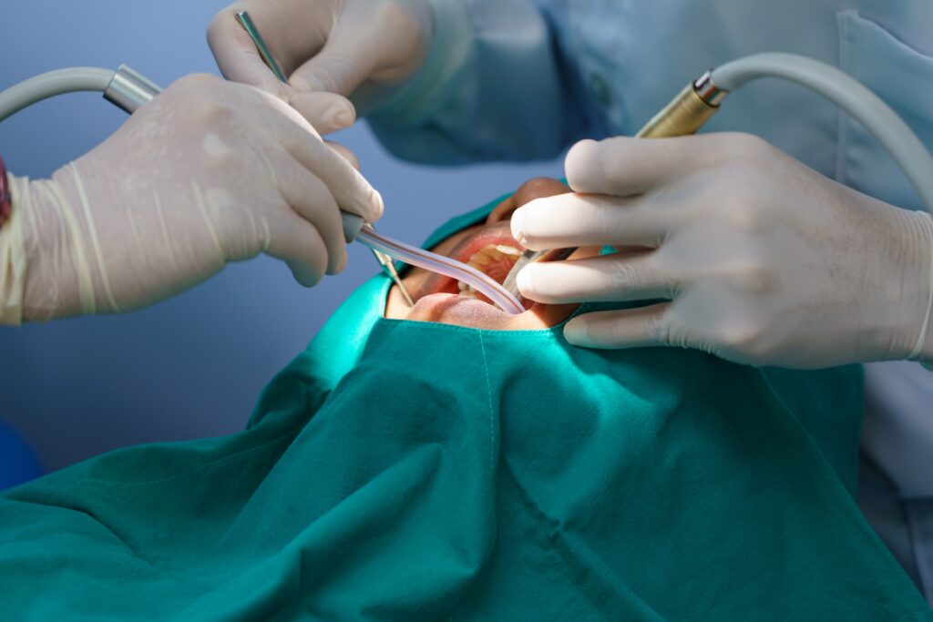 Oral Surgery Hurst