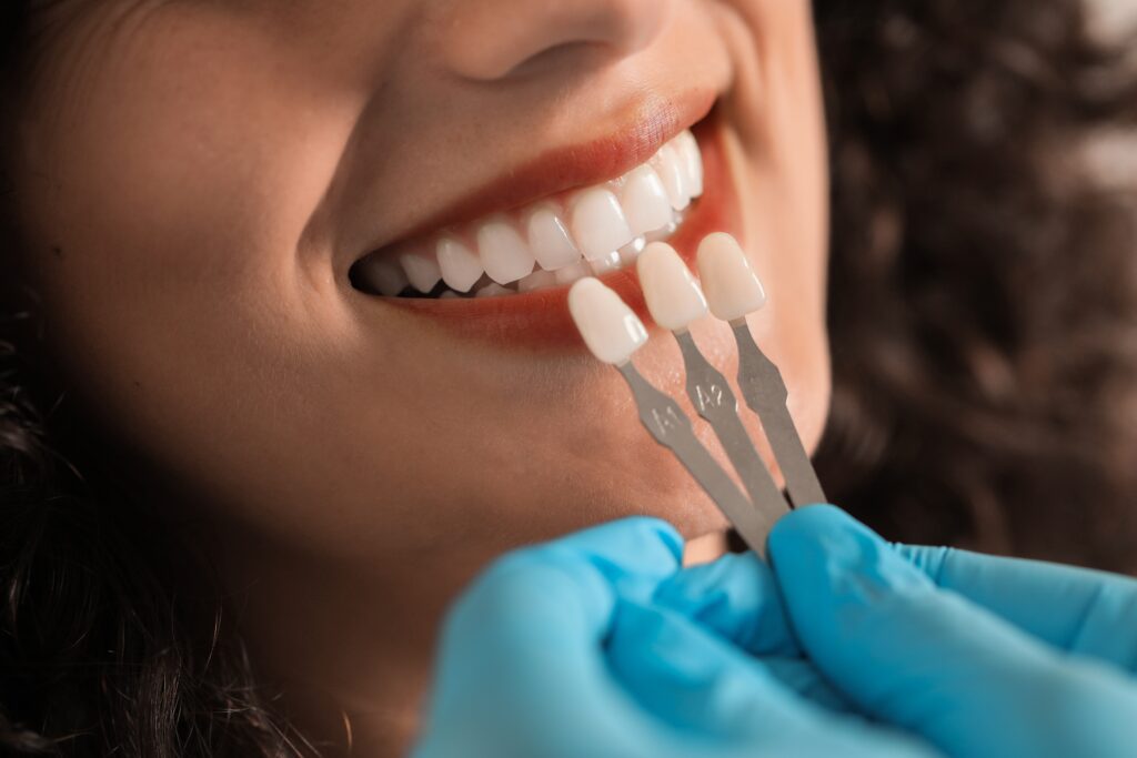 Dental Veneers Frisco