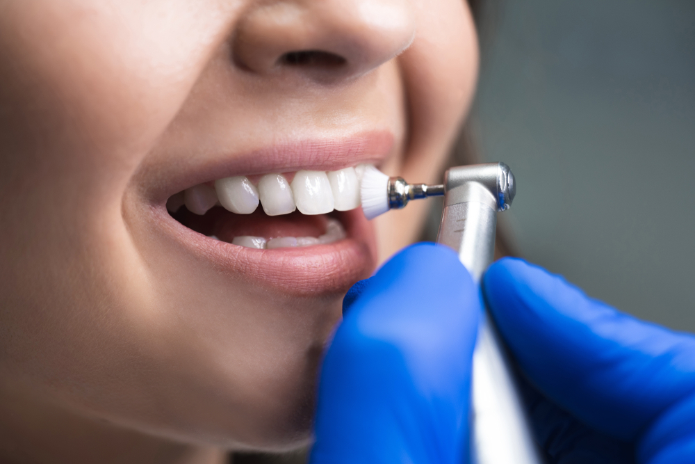 Dental Cleanings Frisco